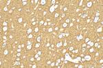 NCAM1/CD56 Antibody in Immunohistochemistry (Paraffin) (IHC (P))