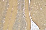 NCAM1/CD56 Antibody in Immunohistochemistry (Paraffin) (IHC (P))