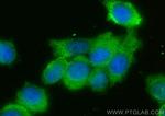 ATPBD3 Antibody in Immunocytochemistry (ICC/IF)