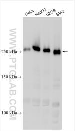 LMTK2 Antibody in Western Blot (WB)