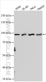 AKAP8 Antibody in Western Blot (WB)