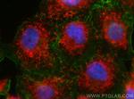 LYRM5 Antibody in Immunocytochemistry (ICC/IF)