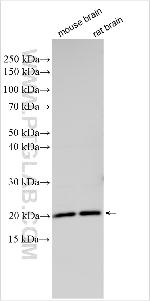 HOXB5 Antibody in Western Blot (WB)