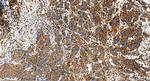 FYB Antibody in Immunohistochemistry (Paraffin) (IHC (P))