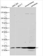 NUDT4 Antibody in Western Blot (WB)
