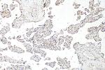 BOD1L Antibody in Immunohistochemistry (Paraffin) (IHC (P))