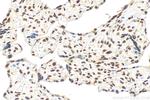 BOD1L Antibody in Immunohistochemistry (Paraffin) (IHC (P))