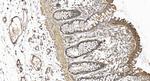 UNK Antibody in Immunohistochemistry (Paraffin) (IHC (P))