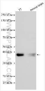 UNK Antibody in Western Blot (WB)
