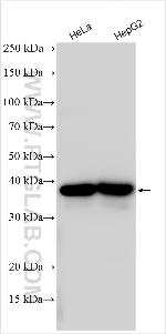 DNAJC17 Antibody in Western Blot (WB)