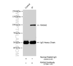 RASA2 Antibody in Immunoprecipitation (IP)