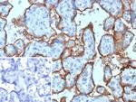 CD168/RHAMM Monoclonal Antibody (HMMR/8021)