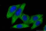 F2 Antibody in Immunocytochemistry (ICC/IF)