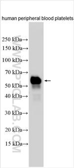 VISTA Antibody in Western Blot (WB)