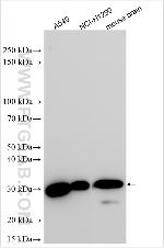 B7-H6 Antibody in Western Blot (WB)