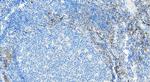 CD209 Antibody in Immunohistochemistry (Paraffin) (IHC (P))