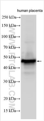 CD209 Antibody in Western Blot (WB)