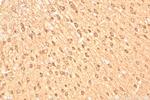 EFHD2 Antibody in Immunohistochemistry (Paraffin) (IHC (P))
