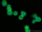 VLGR1 Antibody in Immunocytochemistry (ICC/IF)