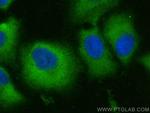 NPEPPS Antibody in Immunocytochemistry (ICC/IF)