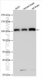 NPEPPS Antibody in Western Blot (WB)