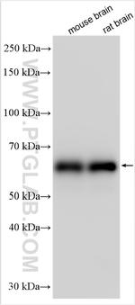 CACNB3 Antibody in Western Blot (WB)