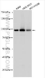 CHML Antibody in Western Blot (WB)