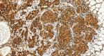 INTS6 Antibody in Immunohistochemistry (Paraffin) (IHC (P))