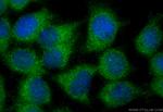 LYRM2 Antibody in Immunocytochemistry (ICC/IF)