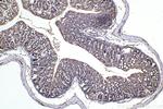 SPTAN1 Antibody in Immunohistochemistry (Paraffin) (IHC (P))