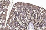 SPTAN1 Antibody in Immunohistochemistry (Paraffin) (IHC (P))