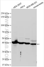 RAD51C Antibody in Western Blot (WB)