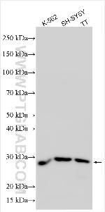 TMEM151B Antibody in Western Blot (WB)
