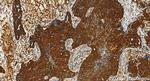 ARFGEF1 Antibody in Immunohistochemistry (Paraffin) (IHC (P))