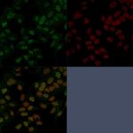 FOXA1/HNF3A Monoclonal Antibody (FOXA1/1241)