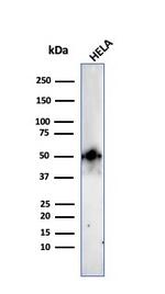 FOXA1/HNF3A Antibody in Western Blot (WB)
