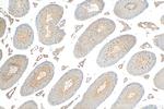 ATP8A2 Antibody in Immunohistochemistry (Paraffin) (IHC (P))