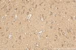 ATP8A2 Antibody in Immunohistochemistry (Paraffin) (IHC (P))