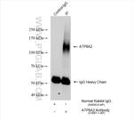 ATP8A2 Antibody in Immunoprecipitation (IP)
