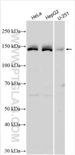 IKBKAP Antibody in Western Blot (WB)