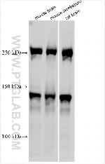 SPTBN4 Antibody in Western Blot (WB)