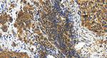LDAH Antibody in Immunohistochemistry (Paraffin) (IHC (P))