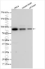 MATK Antibody in Western Blot (WB)