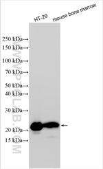 NGAL Antibody in Western Blot (WB)
