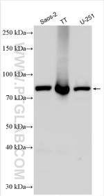 KBTBD6 Antibody in Western Blot (WB)