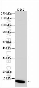 HBG2 Antibody in Western Blot (WB)