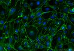 VE-cadherin/CD144 Antibody in Immunocytochemistry (ICC/IF)