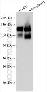 VE-cadherin/CD144 Antibody in Western Blot (WB)