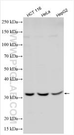 DRAM Antibody in Western Blot (WB)