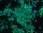 GPR112 Antibody in Immunocytochemistry (ICC/IF)